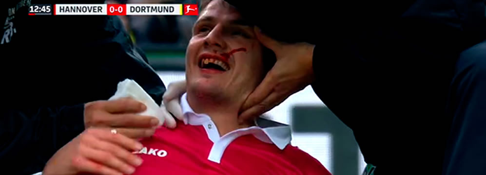 Pirmin Schwegler Krebs Pirmin Schwegler Krebs