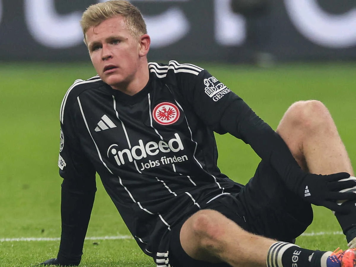 Eintracht-Stürmer Burkardt fällt noch länger aus als angenommen