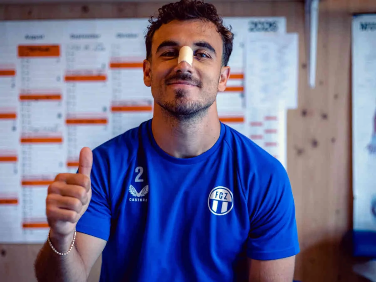 FCZ-Captain Lindrit Kamberi hat sich vierfachen Nasenbeinbruch zugezogen